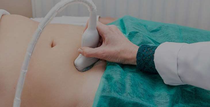 Fila de espera para exame de Ultrassonografia passa de 58 mil na Regulação de Anápolis e ameaça travar atendimentos e cirurgias