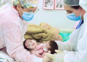 Gêmeas siamesas de Manaus passam por cirurgia de separação em Goiânia