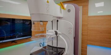 Anápolis tem mamografias e exames de raio-X gratuitos para mulheres na Santa Casa